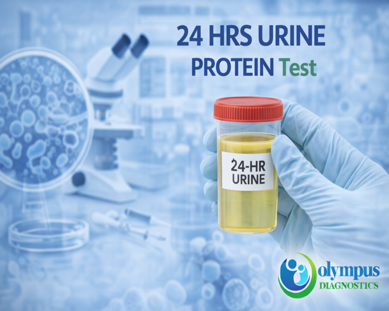 24 HRS URINE PROTEIN
