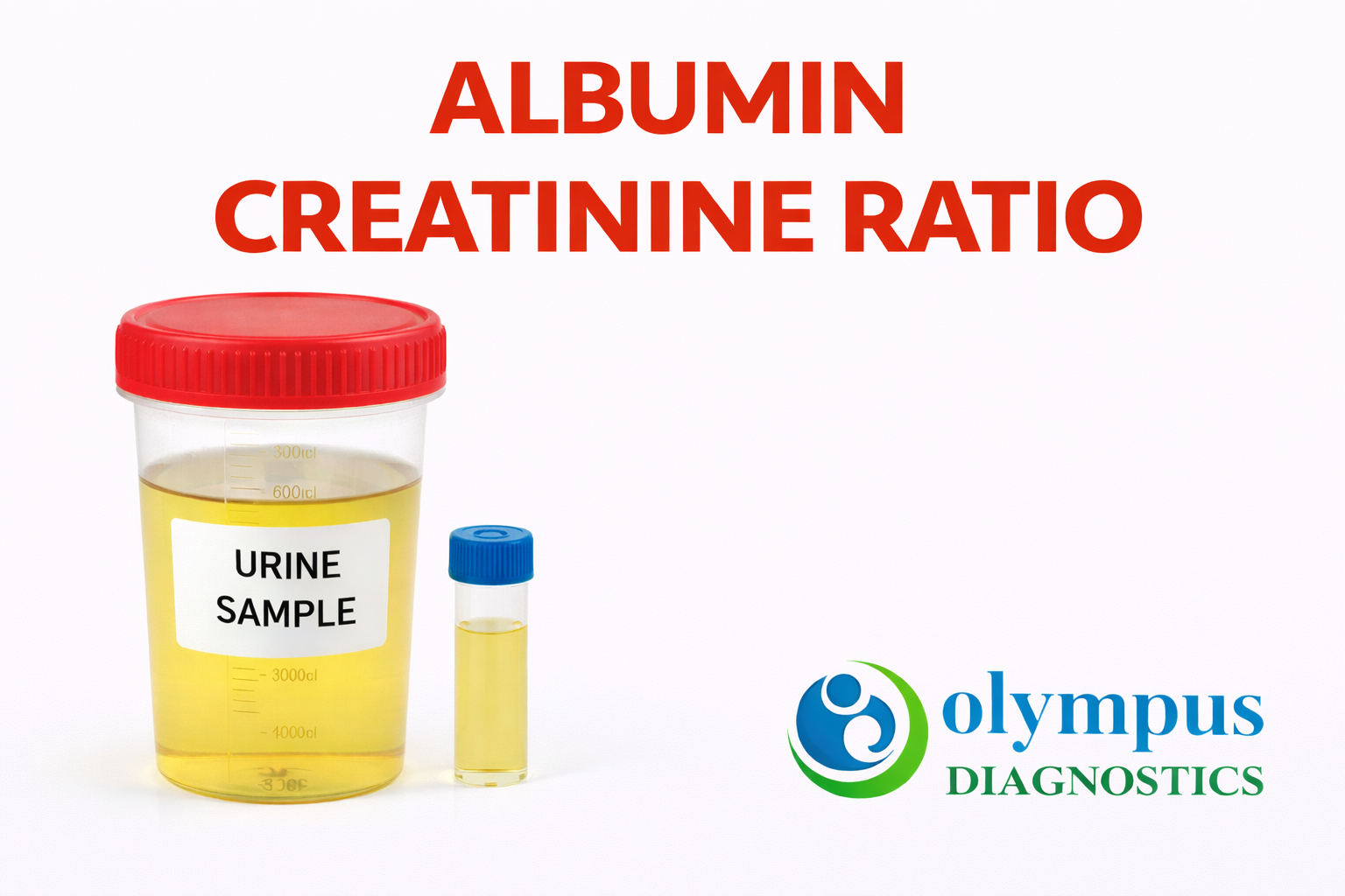 albumin creatinine ratio
