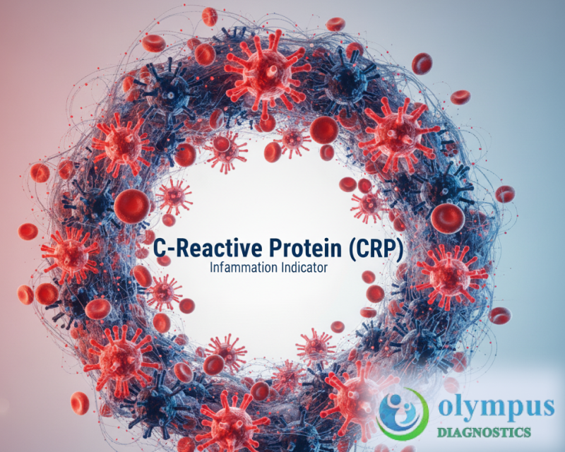  C-Reactive Protein (CRP) -Qualitative