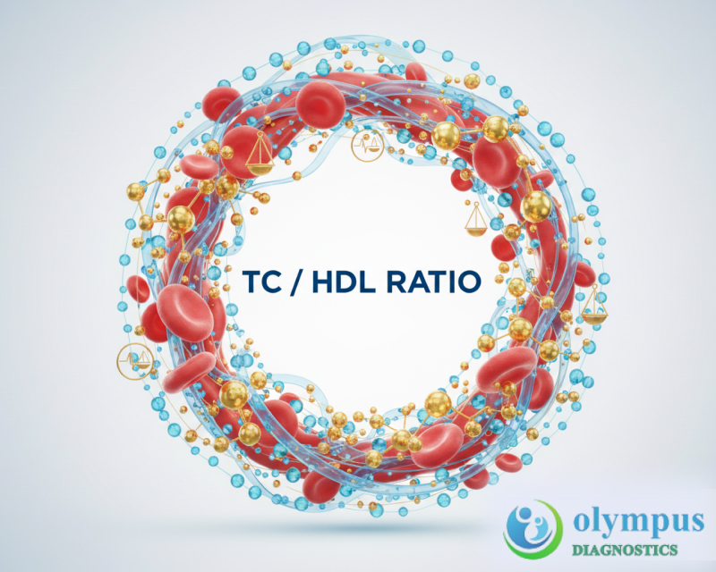 TC/HDL