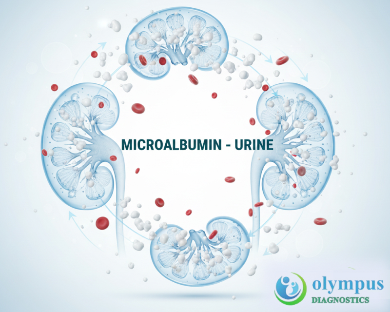 MICROALBUMIN - URINE