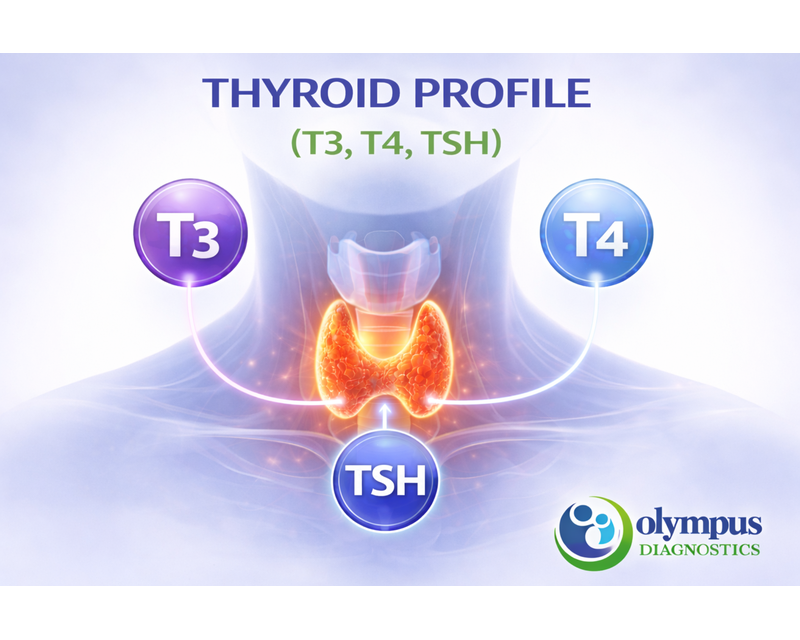 THYROID PROFILE (T3, T4, TSH)