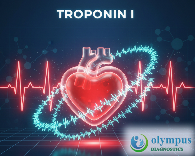 TROPONIN I