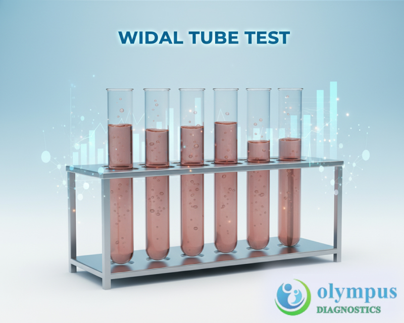 WIDAL TUBE TEST